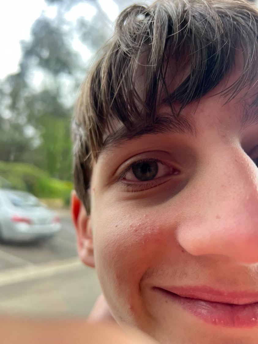 attached photo